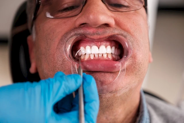 Was ist Kieferorthopädie?